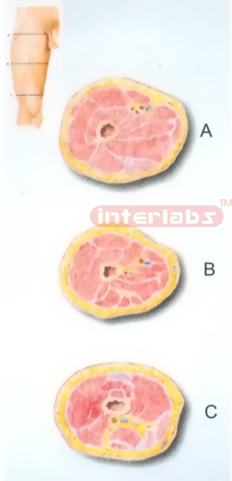 HUMAN TRANSVERSE SECTION THROUGH THE PROXIMAL 1/3 OF THE RIGHT THIGH (A, B, C)